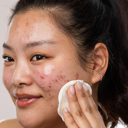 SEBIACLEAR Eau Micellaire